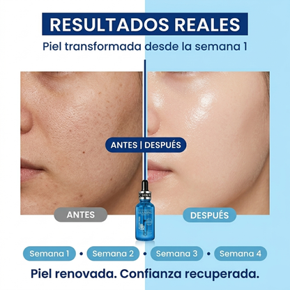 HydraSkin™ — Sérum Facial Coreano · Ácido Hialurónico B5 Premium